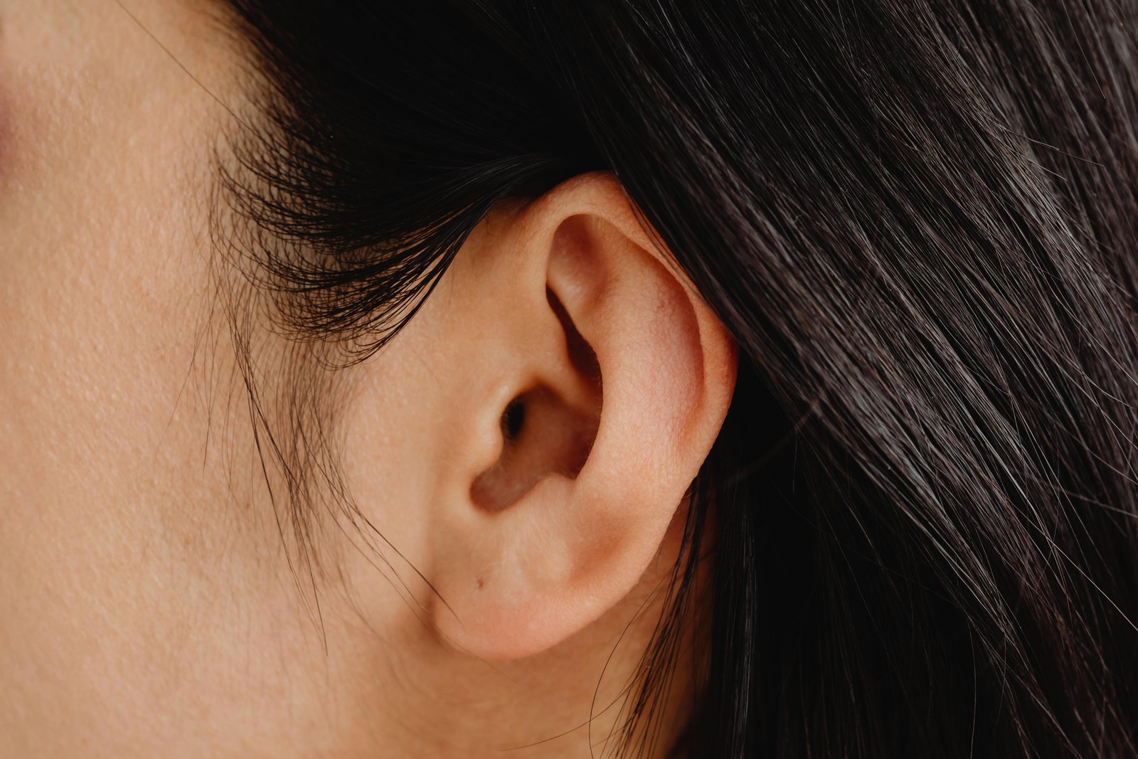ear pinning surgery