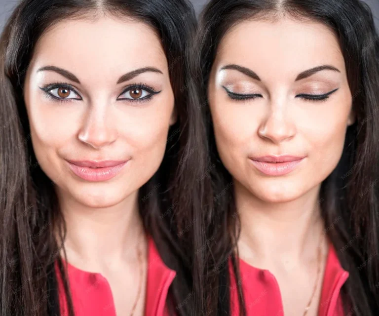 kris jenner before and after face lift