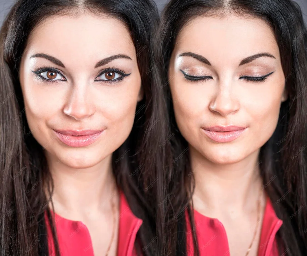 kris jenner before and after face lift